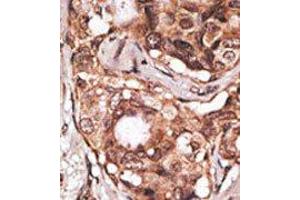 Image no. 2 for anti-Melanoma Antigen Family B, 2 (MAGEB2) (N-Term) antibody (ABIN358653) (MAGEB2 antibody  (N-Term))