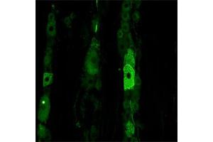 IF on rat trigeminal using Mouse monoclonal antibody to rat p75NTR (ABIN350707) at a concentration of 10 µg/ml. (NGFR antibody)