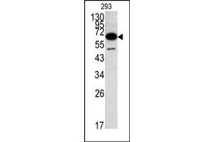 Image no. 1 for anti-Methionyl Aminopeptidase 2 (METAP2) (N-Term) antibody (ABIN357679) (METAP2 antibody  (N-Term))