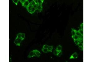 Detection of PAP in MCF7 cells using Polyclonal Antibody to Prostatic Acid Phosphatase (PAP) (ACPP antibody  (AA 217-386))