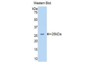 Western Blotting (WB) image for anti-phosphorylase, Glycogen, Liver (PYGL) (AA 73-267) antibody (ABIN1860384) (PYGL antibody  (AA 73-267))