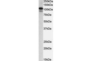 Western Blotting (WB) image for anti-SATB Homeobox 1 (SATB1) (AA 668-681) antibody (ABIN1493900) (SATB1 antibody  (AA 668-681))