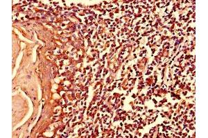 Immunohistochemistry of paraffin-embedded human tonsil tissue using ABIN7174965 at dilution of 1:100 (Myosin X antibody  (AA 1-97))