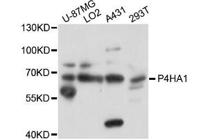 Western blot analysis of extracts of various cell lines, using P4HA1 antibody (ABIN5998436) at 1/1000 dilution.
