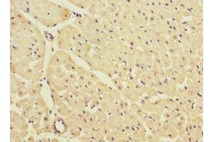 Immunohistochemistry of paraffin-embedded human heart tissue using ABIN7157020 at dilution of 1:100 (KCNJ4 antibody  (AA 316-445))
