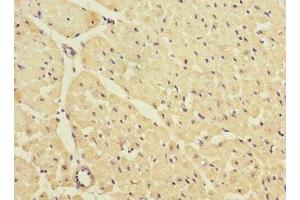 Immunohistochemistry of paraffin-embedded human heart tissue using ABIN7157020 at dilution of 1:100