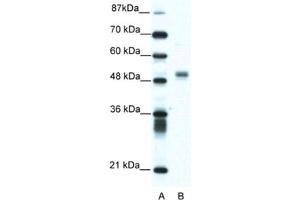 Western Blotting (WB) image for anti-Friend Leukemia Virus Integration 1 (FLI1) antibody (ABIN2461645) (FLI1 antibody)
