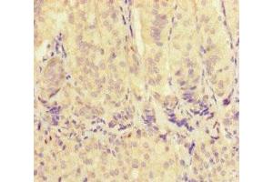 Immunohistochemistry of paraffin-embedded human adrenal gland tissue using ABIN7175563 at dilution of 1:100 (VDAC2 antibody  (AA 2-36))
