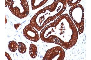 Formalin-fixed, paraffin-embedded human Colon stained with Cytokeratin 19 Mouse Monoclonal Antibody (BA17) (Cytokeratin 19 antibody)