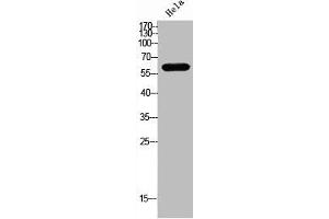 Western Blot analysis of Hela cells using TRP2 Polyclonal Antibody (DCT antibody  (Internal Region))