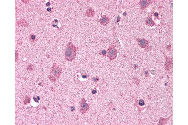 COPS8 antibody  (C-Term)