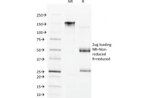SDS-PAGE Analysis Purified CDX1 Mouse Monoclonal Antibody (CDX1/1650). (CDX1 antibody)