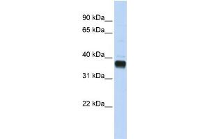 WB Suggested Anti-NUDT18 Antibody Titration:  0. (NUDT18 antibody  (C-Term))