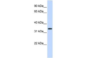WB Suggested Anti-FLJ23356 Antibody Titration:  0.