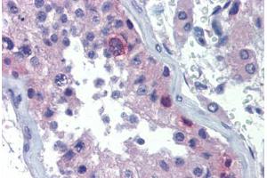 Human Testis (formalin-fixed, paraffin-embedded) stained with RHOXF2 antibody ABIN462204 followed by biotinylated goat anti-rabbit IgG secondary antibody ABIN481713, alkaline phosphatase-streptavidin and chromogen. (RHOXF2 antibody  (AA 108-157))