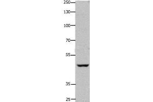 Western Blot analysis of Hela cell using FOXD3 Polyclonal Antibody at dilution of 1:450 (FOXD3 antibody)
