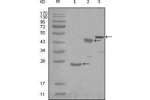 Western blot analysis using KARS mouse mAb against truncated Trx-KARS recombinant protein (1), truncated MBP-KARS (aa90-174) and full length KARS (aa1-188) transfected CHO-K1 cell lysate (3). (KARS antibody  (AA 90-174))