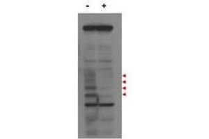 Western blot using  affinity purified anti-MLF1IP antibody shows detection of endogenous MLF1IP protein (a tier of four modified protein bands indicated by the arrowheads) in lysates of Hela cells treated with control luciferase shRNA (lane 1), and detection of MLF1IP in Hela cells transfected with MLF1IP (lane 3). (MLF1 antibody  (C-Term))