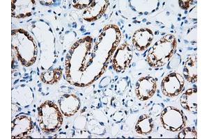 Immunohistochemical staining of paraffin-embedded Human Kidney tissue using anti-IGF2BP2 mouse monoclonal antibody.