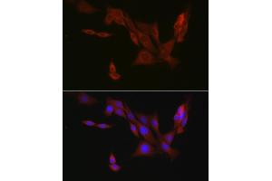 Immunofluorescence analysis of PC-12 cells using EIF4ENIF1 Rabbit pAb (ABIN7267051) at dilution of 1:100 (40x lens).