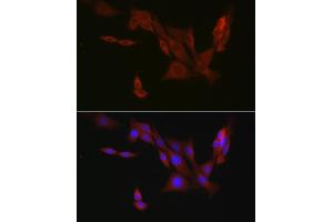 Immunofluorescence analysis of PC-12 cells using EIF4ENIF1 Rabbit pAb (ABIN7267051) at dilution of 1:100 (40x lens). (EIF4ENIF1 antibody  (AA 150-250))