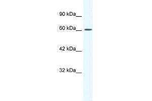 WB Suggested Anti-CACNB2 Antibody Titration:  1.