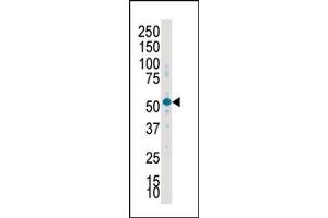 Image no. 2 for anti-serum/glucocorticoid Regulated Kinase 2 (SGK2) (C-Term) antibody (ABIN360349) (SGK2 antibody  (C-Term))