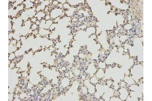 Immunohistochemistry (IHC) image for anti-4-Aminobutyrate Aminotransferase (ABAT) antibody (ABIN1876487) (ABAT antibody)