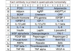 Image no. 1 for Human Obesity Array Q3 (3) (ABIN4956021)