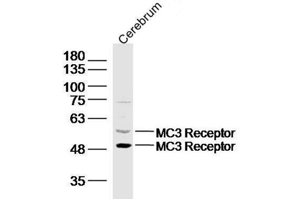 MC3R 抗体  (AA 131-230)