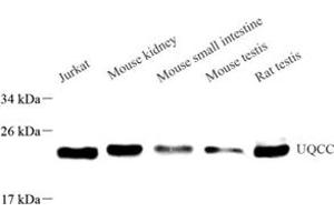 Western blot analysis of UQCC (ABIN7076094) at dilution of 1: 500 (Ubiquinol-Cytochrome C Reductase Complex Chaperone (UQCC) antibody)