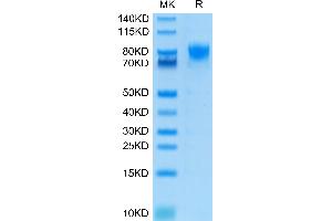 SDS-PAGE (SDS) image for CD226 (CD226) (AA 19-247) protein (Fc Tag) (ABIN7274457)