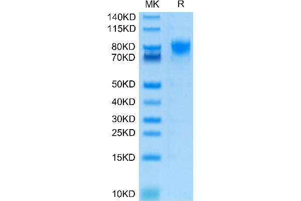 CD226 Protein (CD226) (AA 19-247) (Fc Tag)