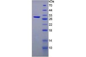 SDS-PAGE analysis of Mouse ITLN1 Protein. (ITLN1/Omentin Protein)