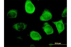Immunofluorescence (IF) image for anti-Keratin 18 (KRT18) (AA 1-430) antibody (ABIN517404)