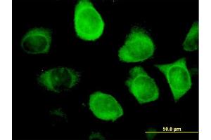 Immunofluorescence of monoclonal antibody to KRT18 on HeLa cell.