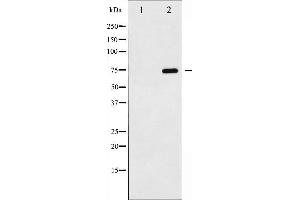Western blot analysis of NF- kappaB p65 phosphorylation expression in TNF-α treated MDA-MB-231 whole cell lysates,The lane on the left is treated with the antigen-specific peptide. (NF-kB p65 antibody  (pSer529))