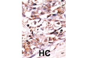 Immunohistochemistry (IHC) image for anti-DUSP13-M1 antibody (ABIN3003768) (DUSP13-M1 antibody)