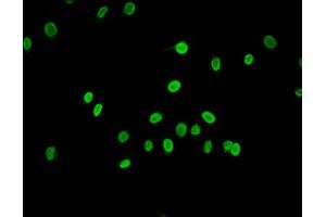 Immunofluorescence staining of Hela cells (treated with 30mM sodium butyrate for 4h) with ABIN7139160 at 1:1. (HIST1H2AG antibody  (acLys15))