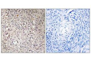 Immunohistochemistry (IHC) image for anti-Glucosaminyl (N-Acetyl) Transferase Family Member 7 (GCNT7) (C-Term) antibody (ABIN1850894) (GCNT7 antibody  (C-Term))