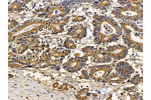 anti-Melanoma Antigen Family D, 4 (MAGED4) (C-Term) antibody