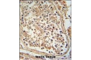 Immunohistochemistry (Paraffin-embedded Sections) (IHC (p)) image for anti-GTP Binding Protein 2 (GTPBP2) (AA 536-564), (C-Term) antibody (ABIN654178)