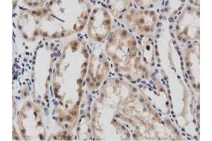 Image no. 2 for anti-DnaJ (Hsp40) Homolog, Subfamily A, Member 2 (DNAJA2) antibody (ABIN1497862) (DNAJA2 antibody)