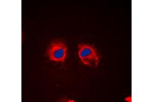Immunofluorescent analysis of Cortactin (pY466) staining in HeLa cells. (Cortactin antibody  (C-Term, pTyr466))