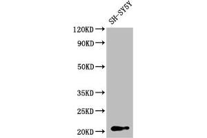 Western Blot Positive WB detected in: SH-SY5Y whole cell lysate All lanes: GNPNAT1 antibody at 1:2000 Secondary Goat polyclonal to rabbit IgG at 1/50000 dilution Predicted band size: 21 kDa Observed band size: 21 kDa (GNPNAT1 antibody  (AA 1-184))