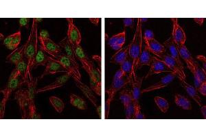 Immunofluorescence analysis of 3T3-L1 cells using CCT2 mouse mAb (green). (CCT2 antibody)