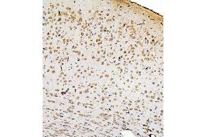 IHC analysis of SMAD2 using anti-SMAD2 antibody (ABIN6719361). (SMAD2 antibody  (AA 83-264))