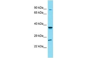 Western Blotting (WB) image for anti-Solute Carrier Family 35, Member G4 (SLC35G4) (N-Term) antibody (ABIN2791457) (SLC35G4 antibody  (N-Term))