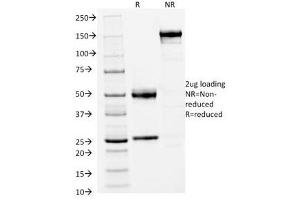 SDS-PAGE Analysis of Purified, BSA-Free FOXA1 Antibody (clone FOXA1/1512).