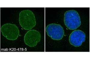 Image no. 1 for anti-Spectrin Repeat Containing, Nuclear Envelope 2 (SYNE2) (AA 1-459) antibody (ABIN1042628) (SYNE2 antibody  (AA 1-459))